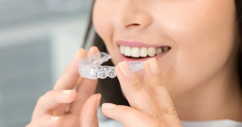 Invisalign in San Antonio, TX