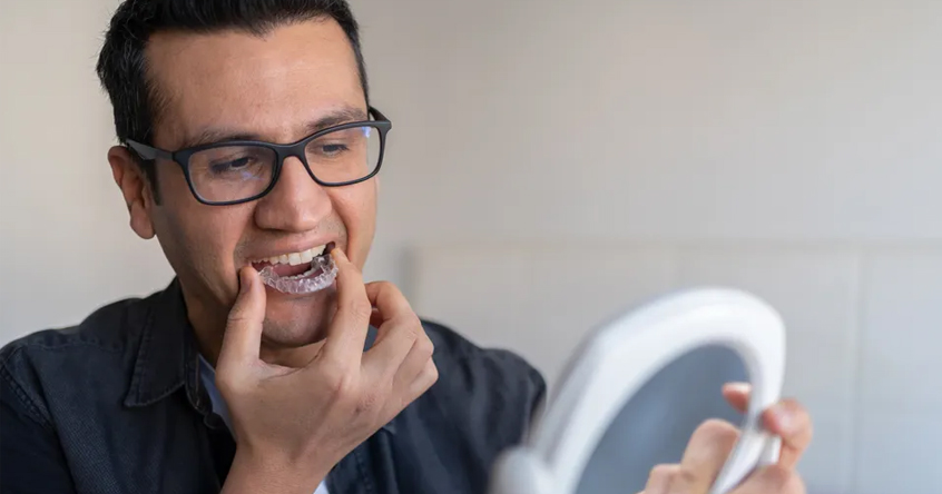 Dental Night Guards in San Antonio, TX