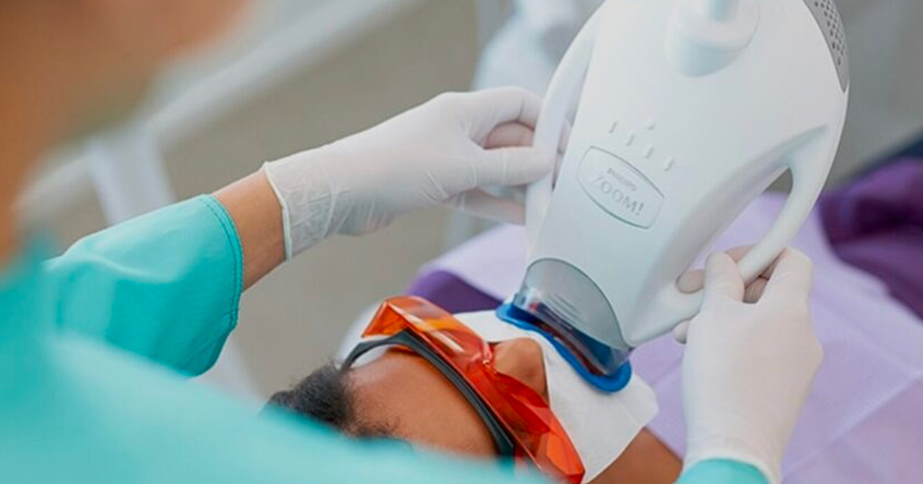 Teeth Whitening