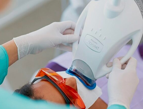Zoom Whitening